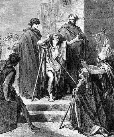 Библейские легенды Исцеление хромого